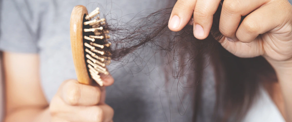 queda de cabelo