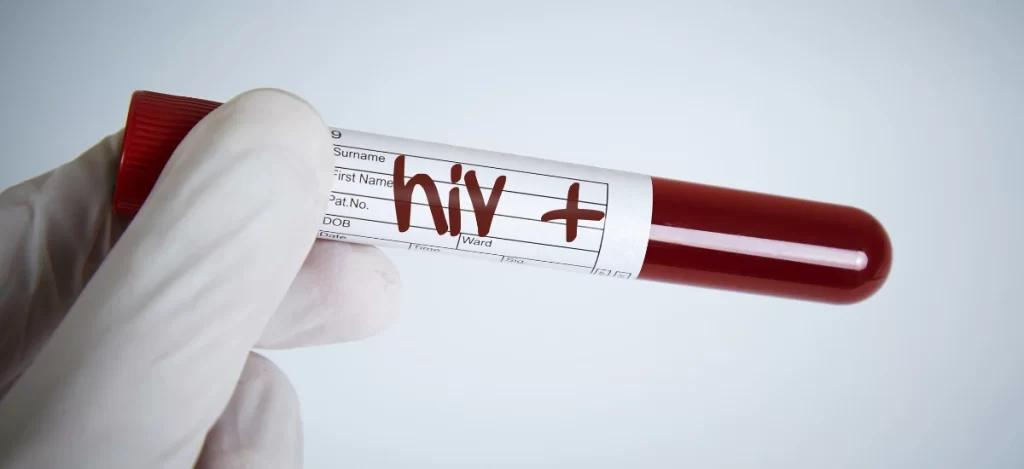 tratamento para hiv